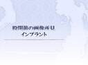 股関節の画像所見・インプラント